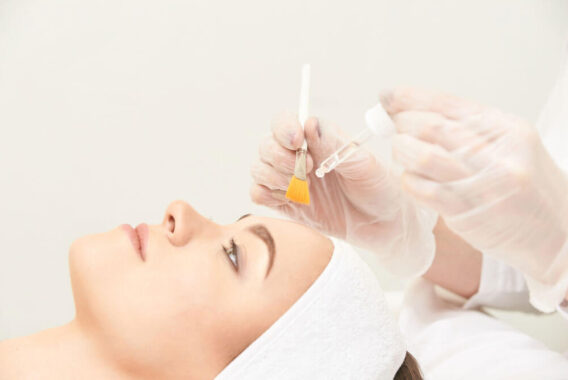 The Many Benefits of Cosmetic Acne Treatments