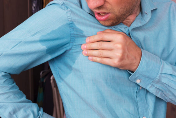 Excessive Sweating: Knowing When to See a Doctor