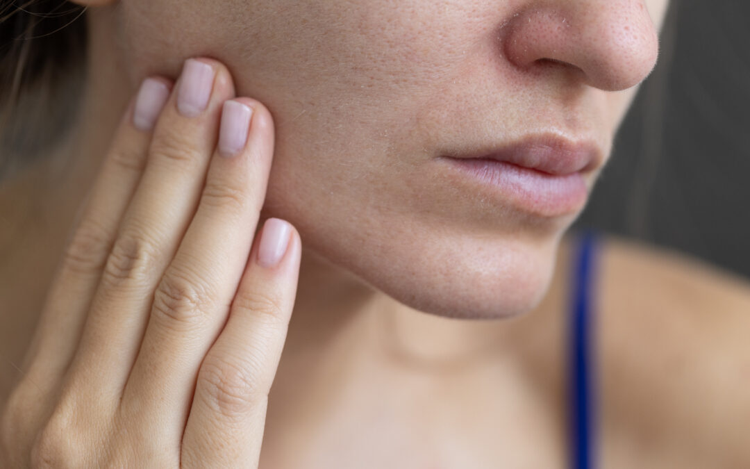 Sanitizers and Cleaning Products May Be Causing Your Itchy